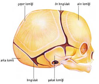 Bebeklerde kafatasının erken kapanması (Kraniosinostoz)