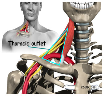Omuz kapanı Hastalığı (Torasik Outlet Sendromu) (TOS)